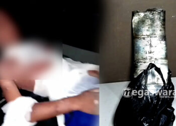 Bocah 10th di Pamijahan Meninggal Dunia Gara gara Main Mercon