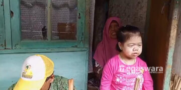 “Sumi” Warga Citamiang Pengidap Dispraksia Butuh Uluran Tangan