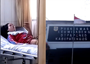 Satu Keluarga di Leuwisadeng Keracunan Tempe Goreng, 2 Orang Dirujuk ke RS