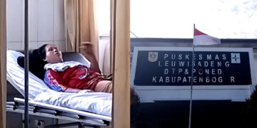 Satu Keluarga di Leuwisadeng Keracunan Tempe Goreng, 2 Orang Dirujuk ke RS