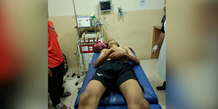 Seorang Pelajar Smp Di Kemang Tewas Saat Tawuran