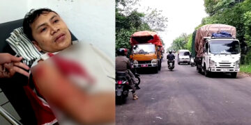 Pengendara Motor di Leuwiliang Jadi Korban Begal Sadis di Jalan Raya Galuga