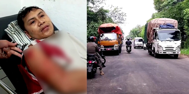 Pengendara Motor di Leuwiliang Jadi Korban Begal Sadis di Jalan Raya Galuga