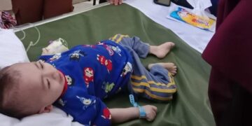 Diduga Alami “Brain Death” Balita Gizi Buruk di Sukabumi Butuh Perhatian Serius.