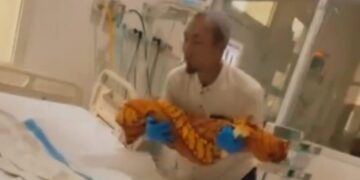 Reaksi Dedi Mulyadi (KDM) Gubernur Jawa Barat terkait kasus Balita di Sukabumi meninggal akibat Cacing Bersarang di Tubuhnya