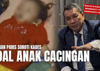 Hotman Paris Desak Gubernur Jabar Panggil Kades Terkait Balita Meninggal karena Cacingan