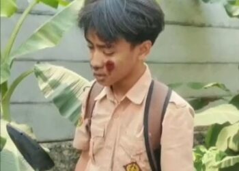 Pelajar SMP Di Cileungsi Diduga Dikeroyok Kelompok Pelajar
