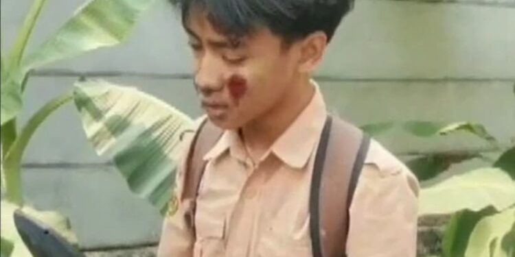 Pelajar SMP Di Cileungsi Diduga Dikeroyok Kelompok Pelajar